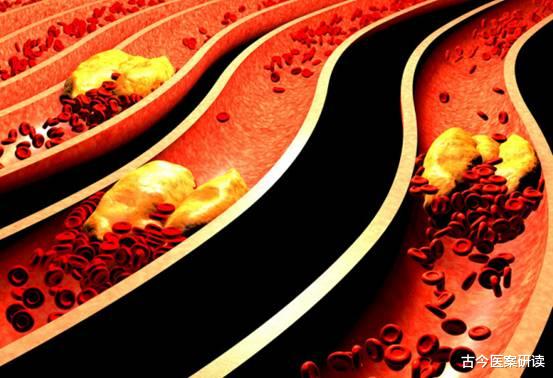 白术|专家提醒：这1物是天然“溶栓王”，敞开吃，血管一天比一天干净