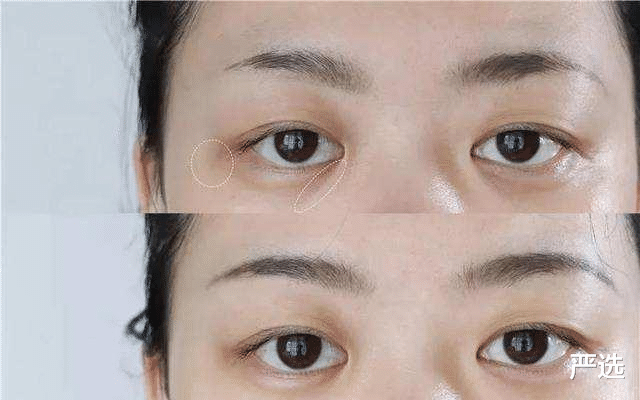 |张雨绮月护肤基金被曝，“精致穷”女孩如何护肤，看此篇足矣