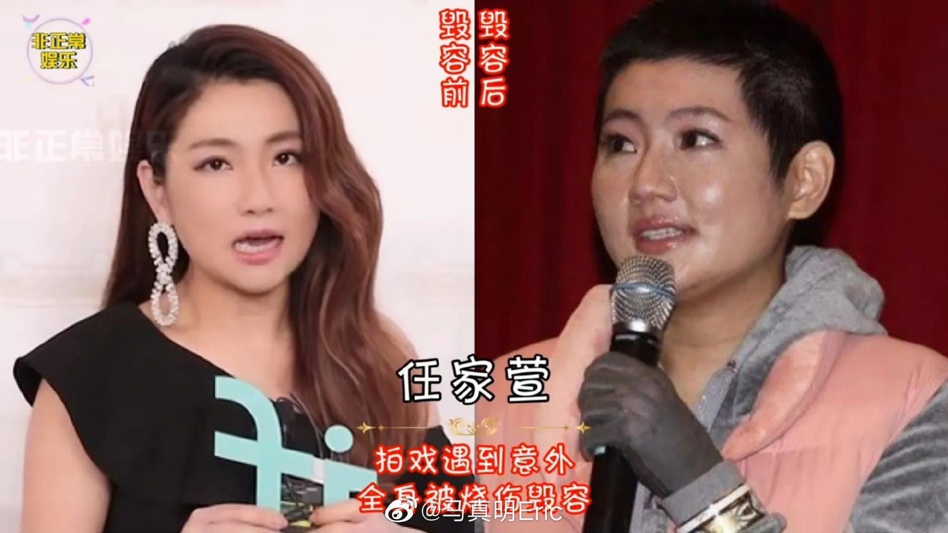 谢孟伟|五位明星意外毁容，最后一个却意外好看。