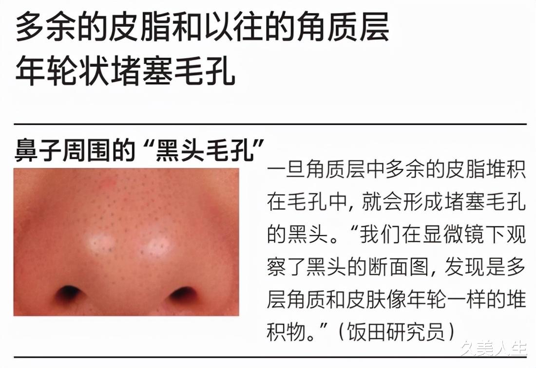 久美人生|朱茵扎双丸子头超减龄 修饰毛孔为颜值加分