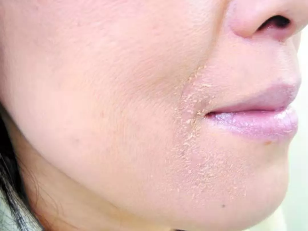 碳水化合物 韩剧女神宣布结婚，可吸引我的是31岁的她，依然满脸胶原蛋白