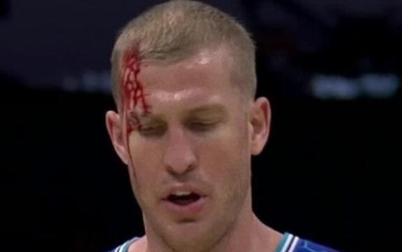 字母哥|NBA大冷门！字母哥43分太脏了，肘击对手血流不止，球迷破口大骂