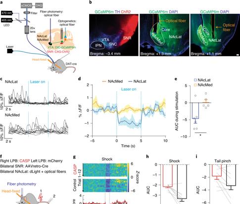 空间站 疼痛影响大脑中多巴胺活动（fMOST技术再次助力神经环路研究）