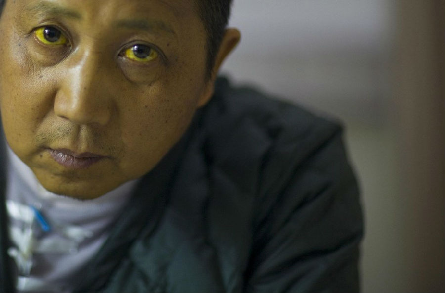 熊猫医学社|40岁男子转氨酶280，确诊肝硬化，医生咆哮：3个习惯，是“祸根”