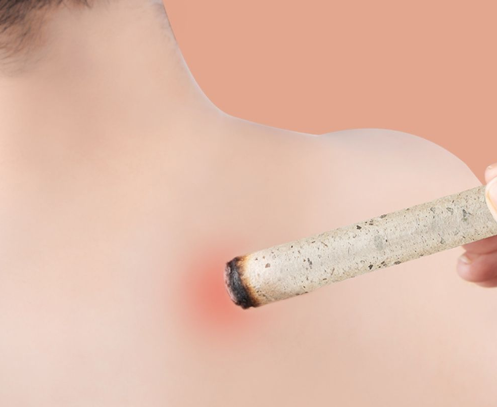 艾灸|“艾”在中秋,“灸”出健康!