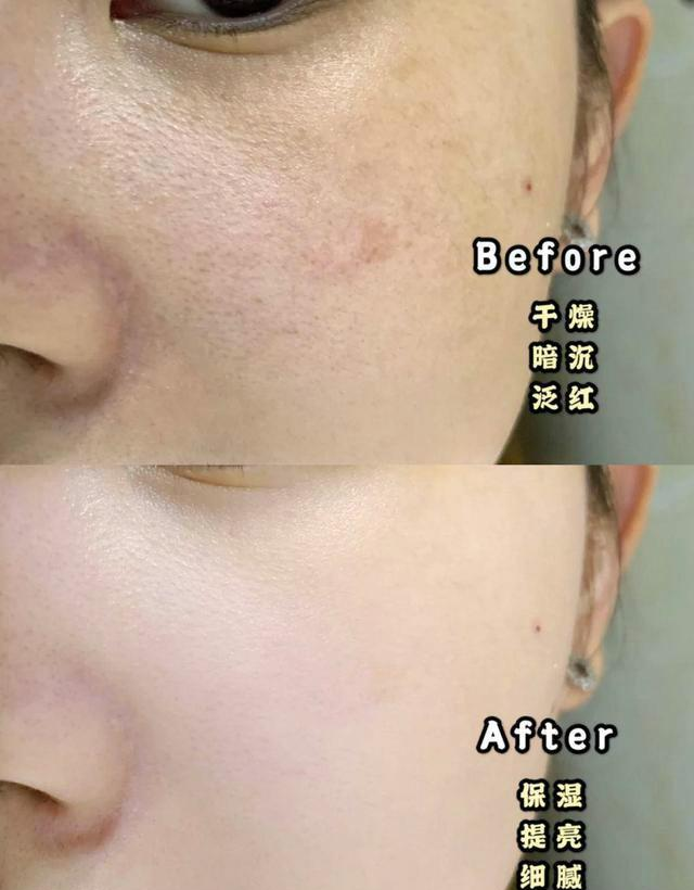 iu|撞脸IU的韩国女网红，30岁依旧童颜逆天，还是8岁孩子的妈？