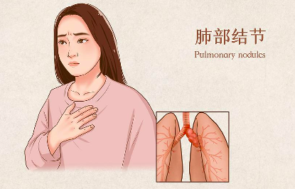 天天听健康 肺结节“很怕”一种水，并非鸭血汤，你若常喝，消炎散结，肺“感激不尽”