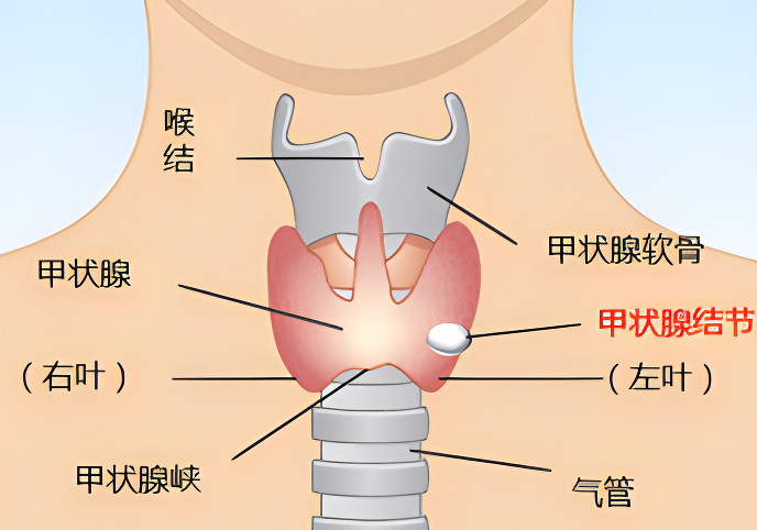 痛风|甲状腺天然的“保护伞”被发现,不是山药,你若爱吃,结节或慢慢消失