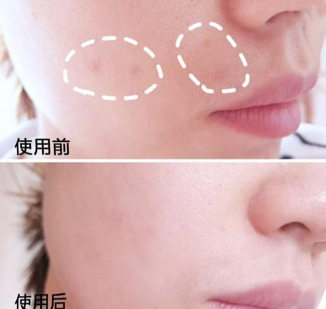 好物官|福建连续打6年“美白针”的女人,如今怎么样了?网友:难以置信