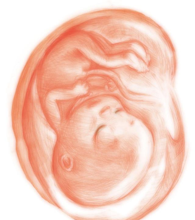 知否知否啊|小宝宝在妈妈肚子里倒着不会难受吗?