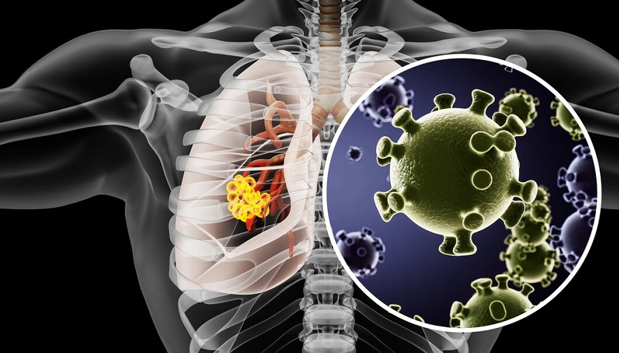 千金芳|最新公布的养肺食物,绿豆汤只能排第三,第一名你绝对猜不到
