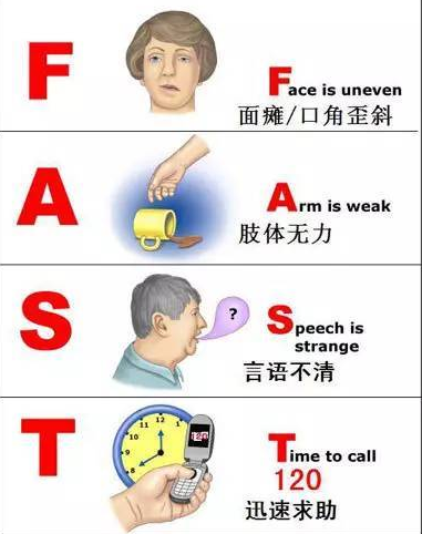 中风|快速判断中风，拯救生命
