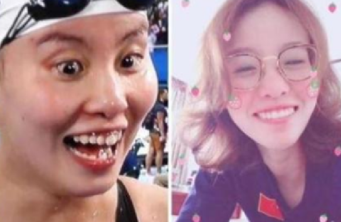 傅园慧|有种“整容”叫傅园慧,整牙后颜值飙升成女神,相信baby的话了