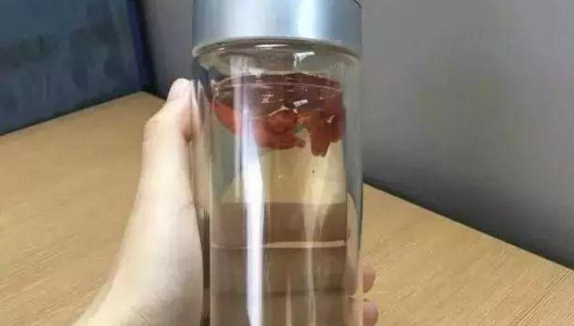 悠悠聊社会 保温杯突然爆炸,把天花板炸了个洞,莫让保温杯变“夺命杯”