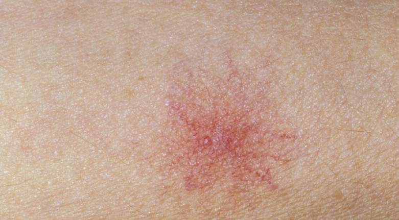 肝脏|多家医院联合停止食用：1种“米”或比烟酒还毁肝脏，别再当成宝