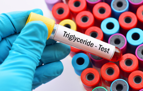 医生|血脂的“溶解剂”已找到,不是山楂,医生提醒:你若爱吃,血管软如水