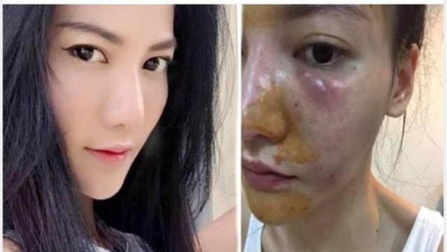 好物官|泰国女子打6年美白针，已经变成这样？网友：美白其实没这么麻烦