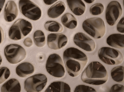 天天听健康|身体若出现3个异常，骨骼或已“酥的掉渣”，占一个也要养骨了