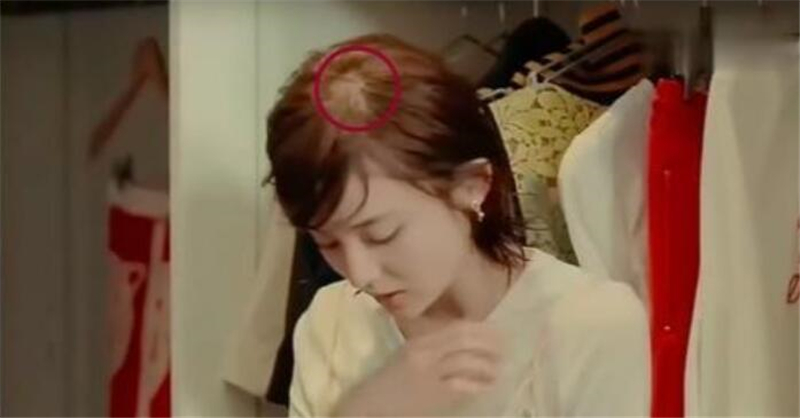 古力娜扎|娜扎分享生发教程，从严重脱发逆袭成“狮子头”，原来秘诀全靠吃