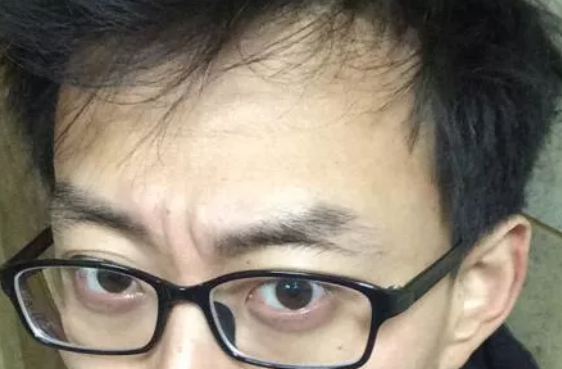 玄风命理|有这六种眉毛的男人，不吉利，命运多舛！