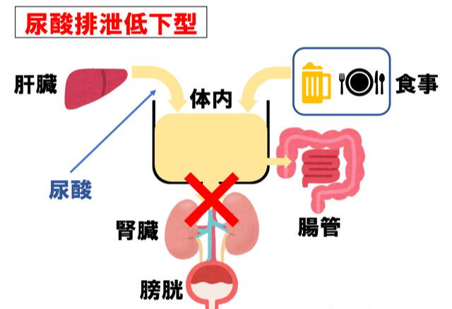 小方说健康|肾代谢问题导致无法排尿酸，怎么调理代谢？