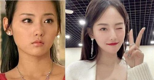 好物官|泰国女子打6年美白针，已经变成这样？网友：美白其实没这么麻烦