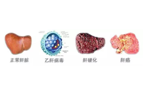 医线天 乙肝患者不能吃羊肉？医生：真正不能吃的，已列出清单，建议远离
