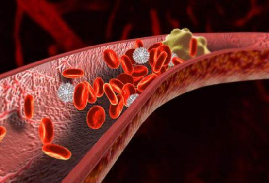 水果|天然“溶栓高手”就在身边，提醒：平时常吃，血栓“退避三舍”