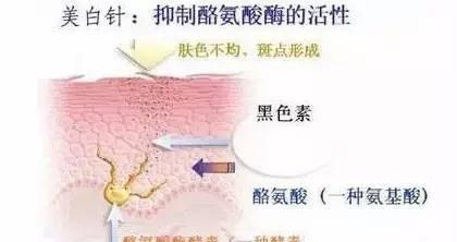 黑色素|国外女子连打6年美白针，如今皮肤发生什么变化？网友：难以相信
