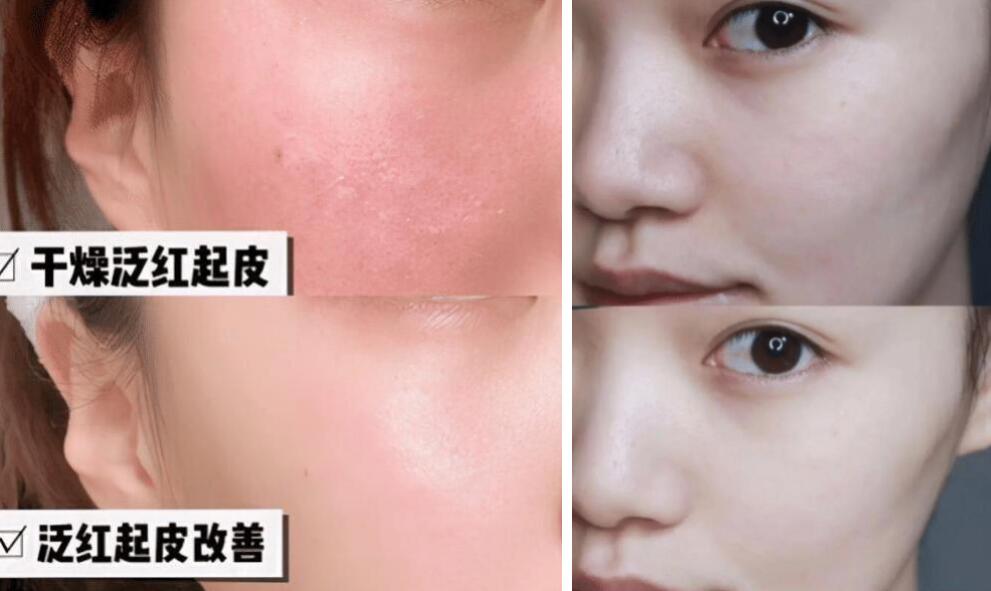 景甜 张馨予自用款面霜，平平无奇“补水小天才”，李佳琦：干敏皮亲妈