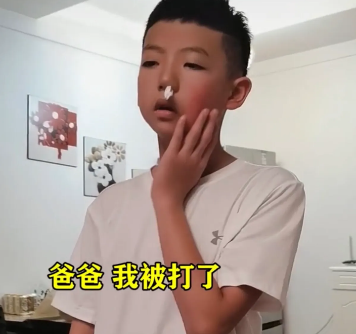 新晋宝妈育儿记|儿子被打后不愿意给父母惹麻烦，第二天又被打，对方：谁叫你儿子那么怂