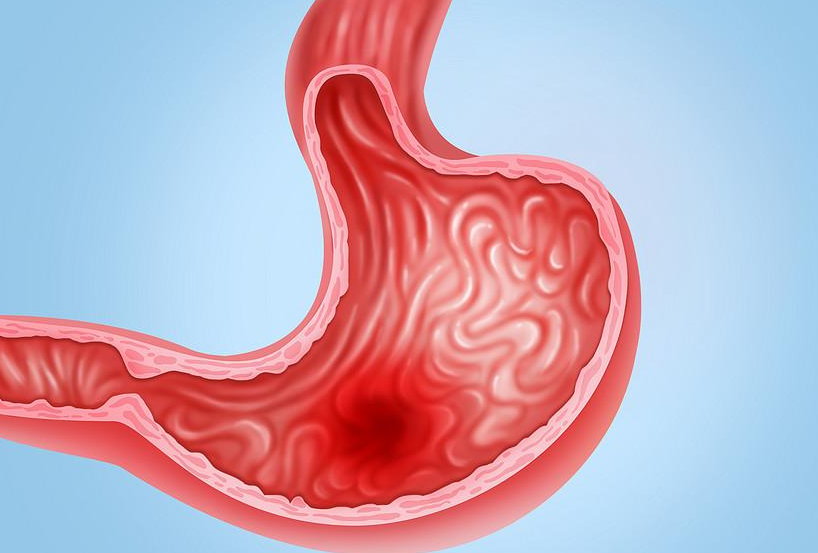牛奶|喝一次相当于8杯热牛奶，消化科主任：你若爱喝，修复胃粘膜，胃会感谢你