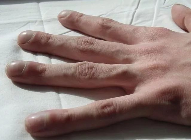 海带|养肺的“冠军”已公布，并非菊花，若能爱喝，清扫尼古丁，肺变干净