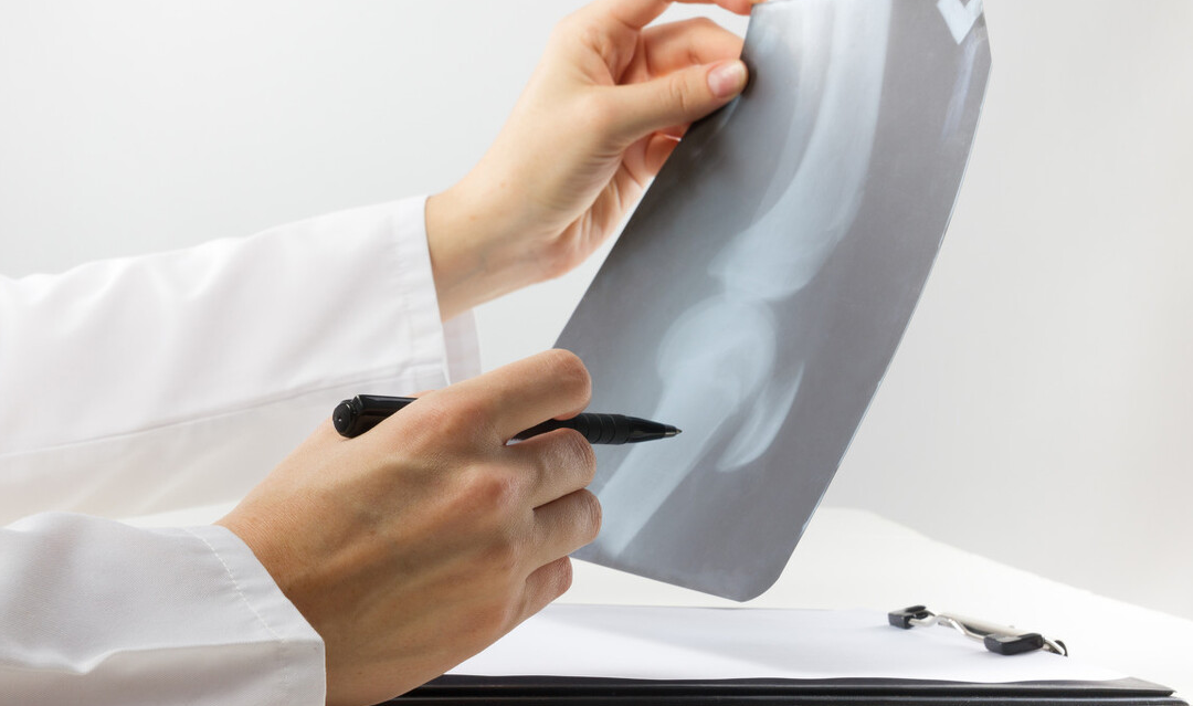 医线天|女孩的“初潮时间”，如果早于这个年龄，孩子可能长不高，需警惕