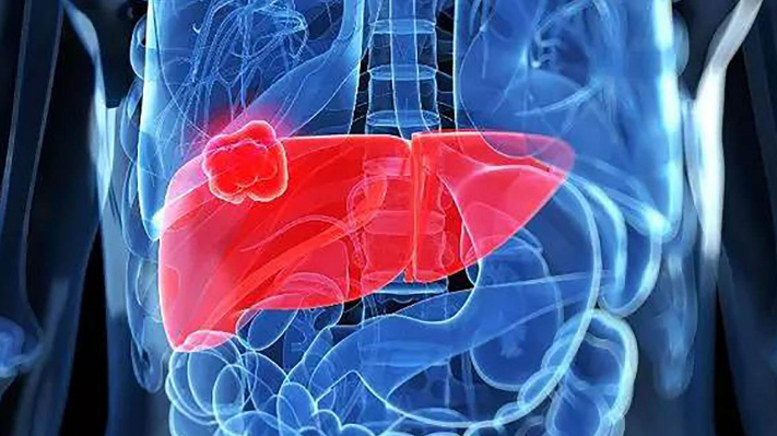 医生|能让“热水变毒水”？医生：停止使用“1热水壶”，否则铁打的肝也扛不住