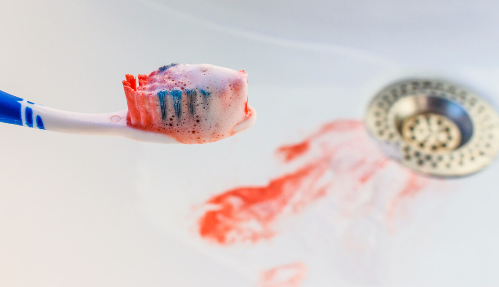 肝脏|42岁男子每天跑步“养肝”，确诊肝硬化晚期，医生：2个习惯害了他