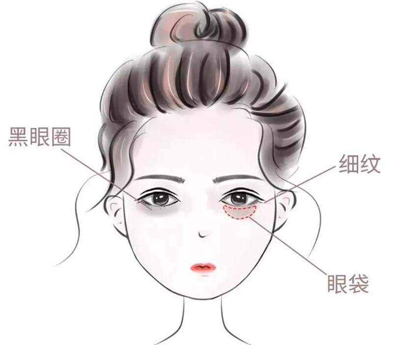 眼霜 擦完眼霜就长脂肪粒？那咱们还真是错怪它了，涂抹时应记住这3点