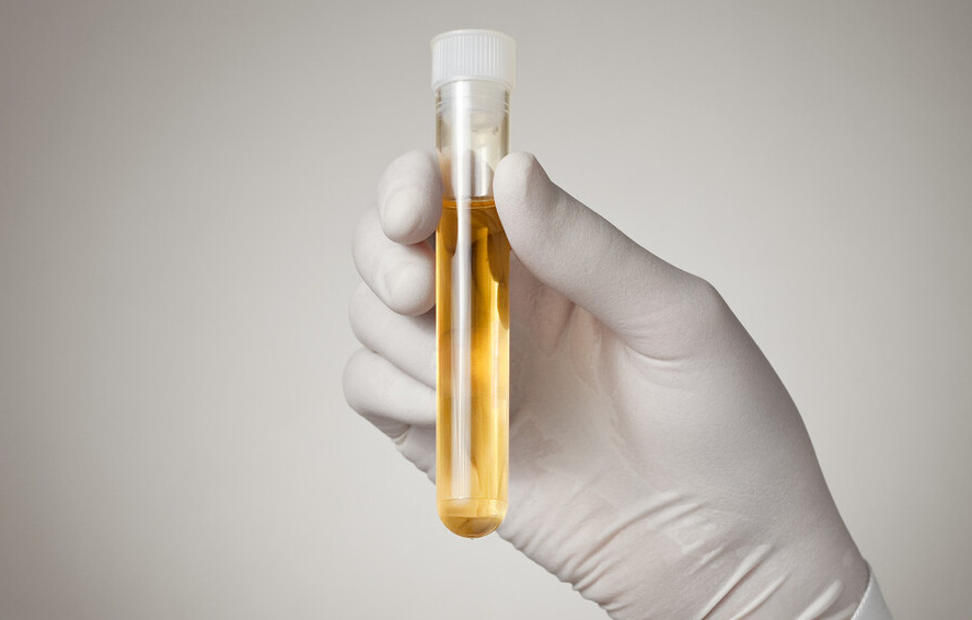 医生|“升酶大户”被揪出，是烟酒的10倍，医生：再不戒掉，肝或“烂如泥”