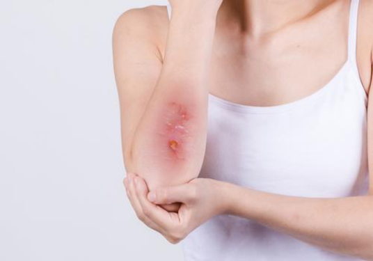 睡眠|白米粥被称为“升糖王”？医生提醒：血糖高的人，2种食物再喜欢也不能多吃