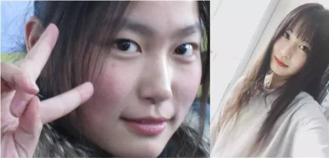希金斯|19岁女子用“215”法，半年减掉50斤，肠胃科医生：值得借鉴