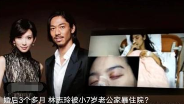 林志玲|林志玲“被家暴”为何不离婚？外媒报道成笑话，看日本离婚啥代价？