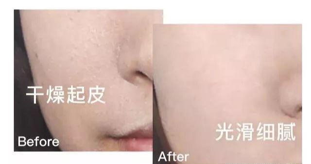 好物官|泰国打“美白针”的女人，整容9年只为“皮肤回春”，如今啥样了