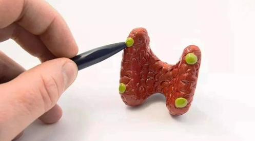 甲状腺结节|60岁大姐甲状腺结节从3.8降低至0.6，医生：常吃“2素1白”或使甲功如初