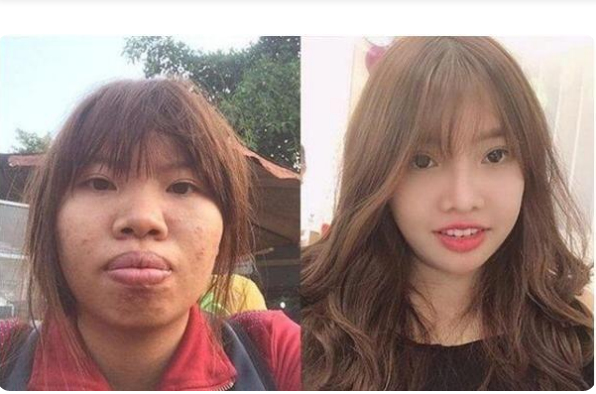 整容|巨额整容嫁入豪门，怀孕之后打回原形，变美梦破碎