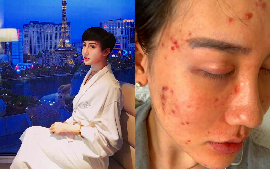 |蛇精男战胜新冠肺炎 公开近况“变正常了”