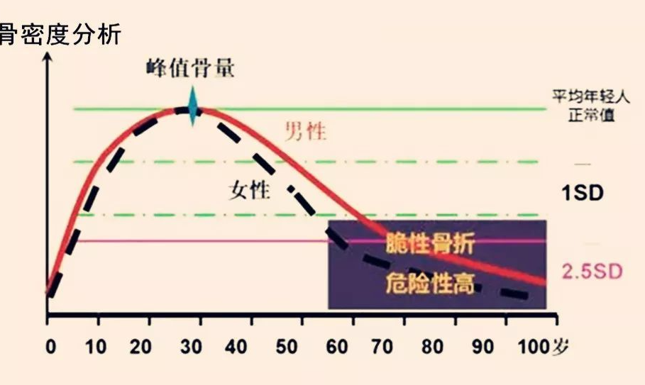 39健康网 骨密度低，晨起时会有3种异常，若全中，可能骨头已经“撑不住了”