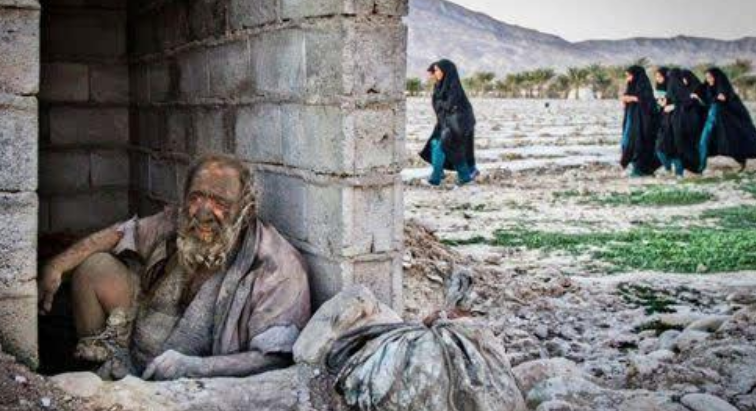 |吉尼斯纪录保持者哈吉，60年不洗澡，身体仿佛佩戴了铠甲