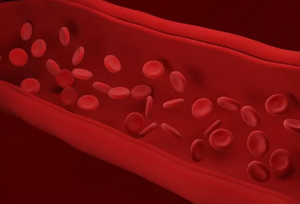 胆固醇|血脂高，头部先知！再次提醒：头部若有3种异常，血管或已“水泄不通”