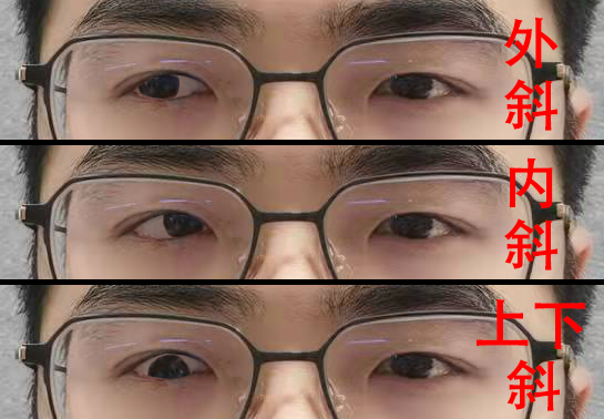 这3中情况,不要配新乐学镜片,包括其防控镜片。