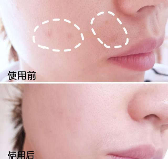 好物官|泰国女子打6年美白针，已经变成这样？网友：美白其实没这么麻烦